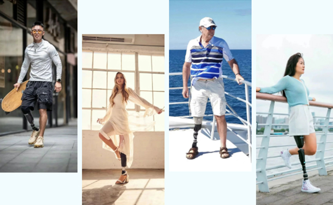 電動(dòng)假肢能否支持跑步、騎車(chē)等高強(qiáng)度活動(dòng)？