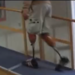 雙小腿假肢視頻