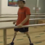 雙大腿假肢視頻